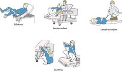 **squatting position is best b/c it opens up pelvic outlet

• lateral recumbent takes pressure off perineum
• medical model tries to mimic squatting during contractions w/ stirrups