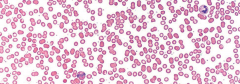 ¿qué leucocitos se pueden identificar en el frotis sanguíneo?