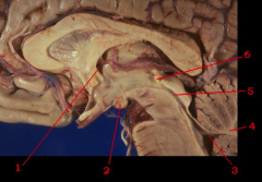 Match each structure on the image below to the correct answer from the list provided. Please note: some answers may be used more than once.

A.	Fourth ventricle of brainstem
B.	Posterior commissure of cerebral hemisphere
C.	Mammillary body of ...
