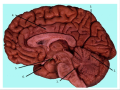 The fold of dura mater that projects between the cerebral hemispheres and the cerebellar hemispheres is called the _____________ (two words). It extends at an approximate right angle to the falx cerebri.  In addition, the transverse sinus (lab 3) ...