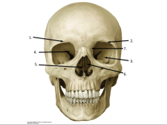 Match each structure on the image below to the correct answer from the list provided. Please note: some answers may be used more than once.

A.	suraorbital margin
B.	greater wing of sphenoid bone
C.	lesser wing of sphenoid bone
D.	perpendicul...