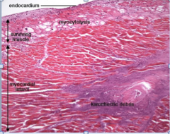 Thin subendocardial layer of cardiac myocytes that can get enough oxygen and nutrients from the cardiac luminal blood before it is pumped out to survive an infarct, survive, not prosper; they commonly catabolize their cytoplasmic contractile prote...