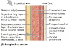 -skin
-superficial fascia
-muscles
-deep fascia
-extraperitoneal fat
-parietal peritoneum