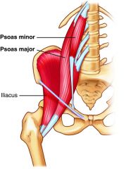 -posterior wall muscle
-obliquely from pelvic crest inserting in the pubic bone
-flex and bend thigh