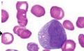 What is the name of this cell in the neutrophilic series