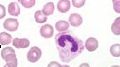 What is the name of this cell in the neutrophilic series