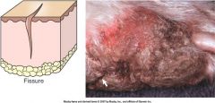 a secondary skin legion.
a linear cut which includes the epidermis +/- dermis. A sharply defined cleft or many small cracks. Seen especially in dry skin

http://www.rvc.ac.uk/review/Dermatology/Lesions/excoriation.htm