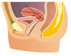 1. Anteversion (AV)
- 1st forward bend (~ 90 Deg relative to vagina)
2. Anteflexion (AF)
- 2nd bend (bends over uterus)

The bends allow the uterus to lie over the bladder which gives support to it inferiorly. 

In the case of retroversion (bend...