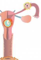 Fertilization typically in the ampulla of the fallopian tubes and implants in the body of the uterus.