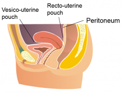 1. Recto-uterine pouch2. Vesico-uterine pouch