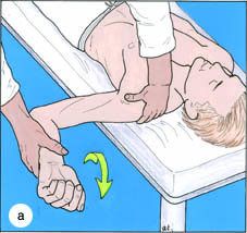 Patient Position: Supine preferred. Sitting or standing ok for on-the-field evaluation. Shoulder abducted to 90deg and elbow flexed to 90 deg.


 


Examiner Position: Standing to side of patient


 


Procedure: Support the arm at the elbow. Th...