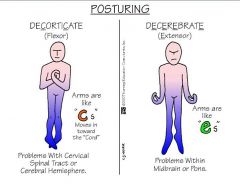 Abnormal extension (decerebrate posturing)