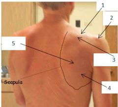 Edge of scapula is labeled