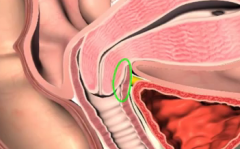 the recesses where the cervix goes into the vagina
roughtly 4 on all sides