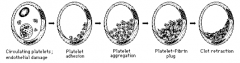 1. circulating platelets; endothelial damage
2. platelet adhesion
3. platelet aggregation
4. platelet-fibrin plug
5. clot retraction