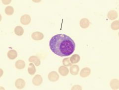 Identify this cell found in connective tissue.