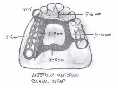 6.0 mm
- should not be placed any further anterior than the anterior rests
- anterior and posterior straps should be perpendicular to the mid-palatine suture