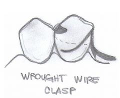 How much of an undercut is needed for a WROUGHT WIRE CLASP?