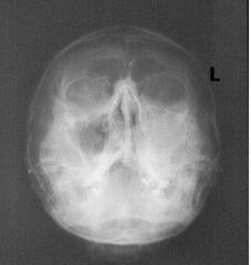 What kind of radiographic view is this?