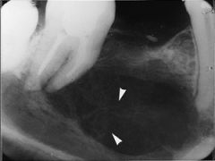 Provide a differential diagnosis for this lesion: