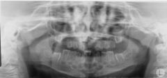 What condition does this patient present with?