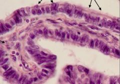 Identify the tissue/structure? What kind of epithelium is present? Identify the cells indicated with arrows?