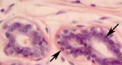 Identify the structures indicated in this section of mammary tissue? Is it active or inactive?