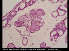 What features are present that are NOT typical of a human lactating mammary gland? Adipose tissue among the lobules.