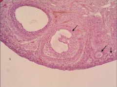 Ovary; Ovarian follicles