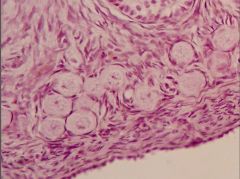 Ovary; these are primordial follicles.