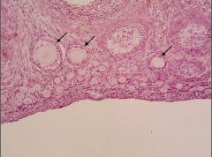 Two unilaminar primary follices; one developing multilaminar primary follicle.