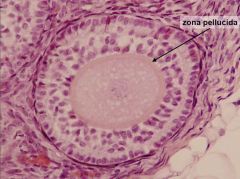 Multilaminar primary follicle; stratified cuboidal epithelium (aka granulosa); NO fluid filled antrum; zona pellucida