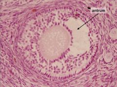 Secondary follicle; stratified cuboidal epithelium (aka granulosa), fluid filled antrum; zona pellucida;