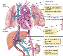 Right atrium ---> Right ventricle ---> Pulmonary artery ---> Pulmonary circulation 

(minimal blood goes this route)

OR

Right atrium ---> Right ventricle ---> Pulmonary artery ---> Ductus arteriosis ---> Descending aorta

(most blood goes this r