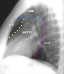 Sections of the mediastinum