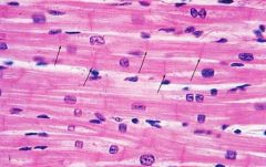 Identify this feature of cardiac muscle