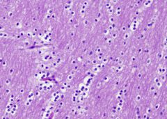 Identify these glial cells