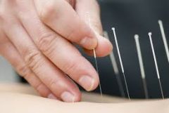 Meaning: sharp 


Examples: acupuncture, acute,acutifoliate