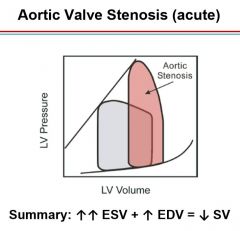 Aortic valve stenosis (left ventricle must create more pressure against a stiff valve).  Pressure gradient above aortic pressure

Crescendo-decrescendo murmur heard loudest over 2nd intercostal space at sternal border