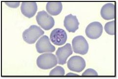 Babesia is usually seen in _______ is transmitted by ______ and treated with_______ and primarily is found in the _____ region