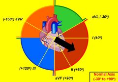 Determining the ventricular axis (vector of the electric conductance)

QRS should be positive in I & II

L axis deviation will be positive in I but negative in II

R axis deviation will be positive in II but negative in I