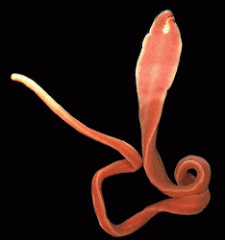 Phylum ___________
(ribbon worm)