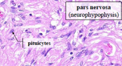 From top to bottom:
Pars distalis (adenohypophysis) (more blood vessels)
Pars intermedia
Pars nervosa (neurohypophysis) (has pituicytes present)
