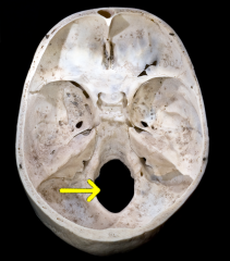 Occipital bone. Outer surface.