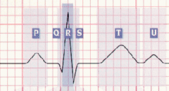 What happens during QRS complex