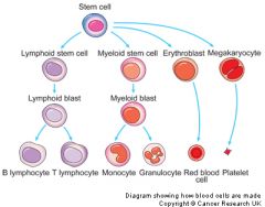 Chronic myelogenous leukemia presentation
