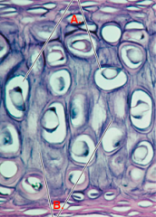 What tissue is this ? 
Elaborate on its function and name the labels A & B. Give an example of where can it be found.