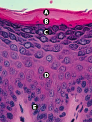 Stratum Spinosum (spines = desmosomes)