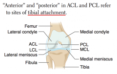 PCL injury
