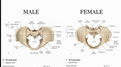 1. The female pelvic brim is oval-shaped whereas the males is somewhat heart-shaped because the sacrum kind of impinges on the space